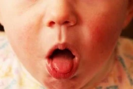 Hà Nội xuất hiện ca ho gà đầu tiên trong năm