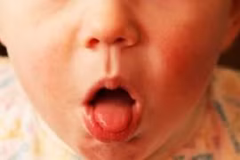 Hà Nội xuất hiện ca ho gà đầu tiên trong năm