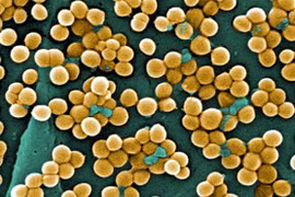 Nhiễm khuẩn tụ cầu vàng nguy hiểm ra sao?