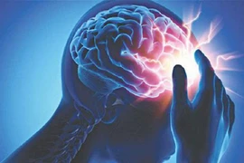 Cách chăm sóc người bệnh đột quỵ có viêm phổi tại nhà