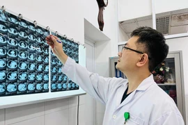 Cắt khối u giáp khổng lồ nằm sâu trong lồng ngực cụ bà 86 tuổi