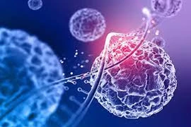 Ăn uống lành mạnh vẫn mắc ung thư giai đoạn cuối vì thói quen này