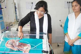 Mẹ sốc khi thấy con sinh ra 2 mình, 4 chân, 4 tay