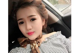 Cô gái sứt môi hở hàm ếch lột xác thành hotgirl