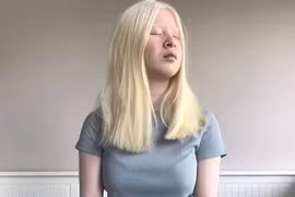 Cô bé bị bố mẹ bỏ rơi trở thành người mẫu nổi tiếng