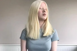 Cô bé bị bố mẹ bỏ rơi trở thành người mẫu nổi tiếng