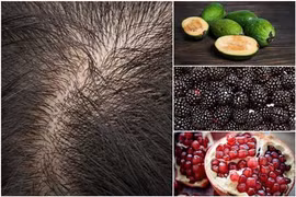 "Thần dược" giúp chị em "đánh bay" nỗi lo rụng tóc