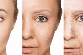 4 thực phẩm là thủ phạm gây lão hóa sớm