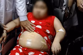 Bé gái mắc bệnh hiếm gặp, gia đình tưởng béo phì