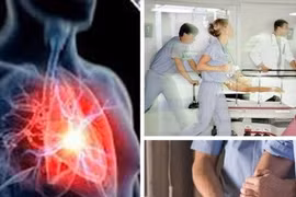 Cô gái 17 tuổi bị đột quỵ, cảnh báo những nguy cơ ở người trẻ