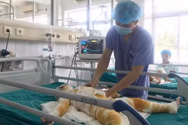 Tin mới nhất về sức khỏe của 3 bé bị bỏng cồn tại lớp trẻ mầm non