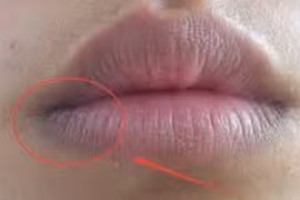 Dấu hiệu trên cơ thể phụ nữ chứng tỏ cặn bã ở tử cung tích tụ