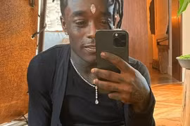 Rapper Mỹ tháo viên kim cương 24 triệu USD khỏi trán