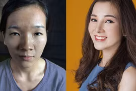 Video: 5 cô gái xấu xí trở thành hot girl sau khi "dao kéo"