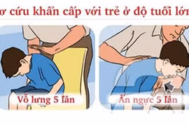 Trẻ tử vong do sặc cháo: Cấp cứu kịp thời có thể cứu mạng trẻ