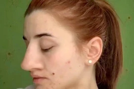 Cô gái khoe video thành hotgirl nhờ sửa mũi, netizen soi ra điểm vô lý