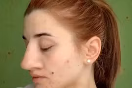 Cô gái khoe video thành hotgirl nhờ sửa mũi, netizen soi ra điểm vô lý