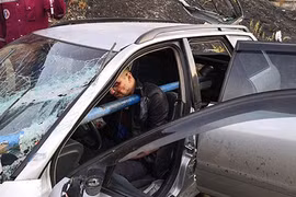 Sống sót kỳ diệu khi bị ống nước kim loại đâm xuyên ngực