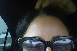 Chi 1.500 bảng để có má lúm đồng tiền