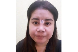 Ham hố nâng mũi giá rẻ, cô gái nhận cái kết không thể đắng hơn