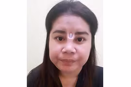 Ham hố nâng mũi giá rẻ, cô gái nhận cái kết không thể đắng hơn