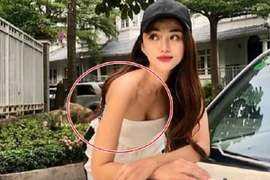 "Bóc mẽ" mỹ nhân Việt sửa ảnh đến mức méo cả tường, lộ da nhăn