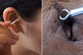 5 bộ phận trên cơ thể không cần vệ sinh sạch sẽ quá nhiều