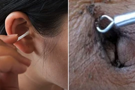 5 bộ phận trên cơ thể không cần vệ sinh sạch sẽ quá nhiều