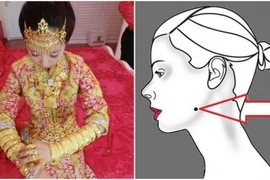 Vị trí vàng của nốt ruồi tài lộc, dự báo cả đời ăn không hết của