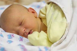 9 biện pháp khắc phục tại nhà cho vàng da ở trẻ sơ sinh