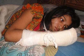 Người vợ bị chồng cắt lìa ngón tay vì muốn đi học