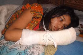 Người vợ bị chồng cắt lìa ngón tay vì muốn đi học