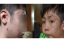 Những đứa trẻ lớn lên trong bạo hành sẽ ra sao khi lớn lên?