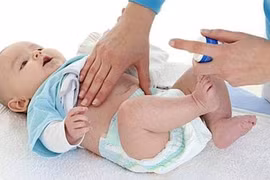 Dấu hiệu nhận biết thoát vị rốn