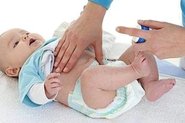 Dấu hiệu nhận biết thoát vị rốn