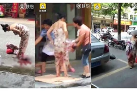 Sản phụ tự bế con về nhà sau khi đẻ rơi trên đường