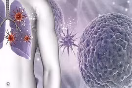 Những thực phẩm lọc sạch khí độc, tăng sức đề kháng cho trẻ