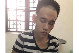 Thanh niên cứa cổ người lạ trong đám tang bố ruột