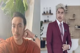 Khuôn mặt nhọn hoắt khác lạ của Kiều Minh Tuấn