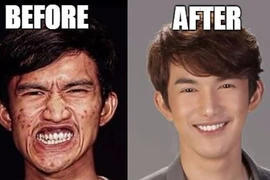 Vỡ mộng với "mặt gốc" không như là mơ của loạt mỹ nam, mỹ nữ Thái