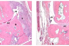 Canada phát triển phương pháp mới điều trị các bệnh tự miễn