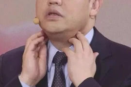 3 dấu hiệu của lưỡi cho thấy có thể bệnh tuyến giáp đang phát triển