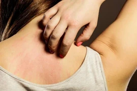 Dấu hiệu ngứa 'vặt vãnh' này lại cảnh báo ung thư