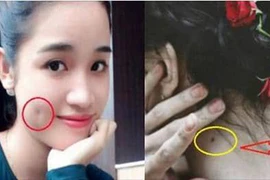 Vận mệnh người có má lúm đồng tiền, nốt ruồi trước ngực hoặc sau gáy