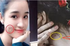 Vận mệnh người có má lúm đồng tiền, nốt ruồi trước ngực hoặc sau gáy