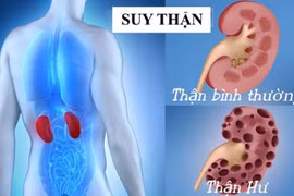 7 thói quen gây hại thận khủng khiếp, chuyên gia khuyến cáo nên bỏ ngay