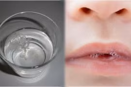 Dấu hiệu đơn giản nhận biết cơ thể có bị nhiễm nấm Candida hay không