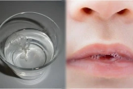 Dấu hiệu đơn giản nhận biết cơ thể có bị nhiễm nấm Candida hay không