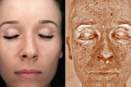 Chụp ảnh ‘tự sướng’ nhiều sẽ khiến bạn nhanh già