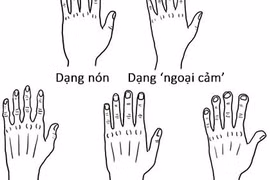 Nhìn dáng bàn tay đoán năng khiếu, tính cách